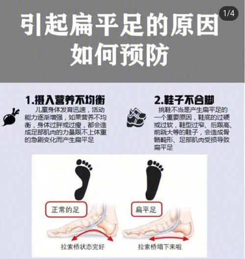 打篮球时足弓酸痛是什么原因？（揭开打篮球防守中足弓酸痛的谜团）
